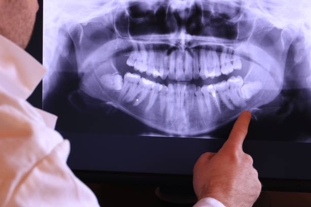 Best Weekend Emergency Dentist in Herculaneum, MO
