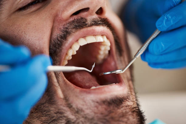 Best Orthodontic Emergency Dentist in Herculaneum, MO